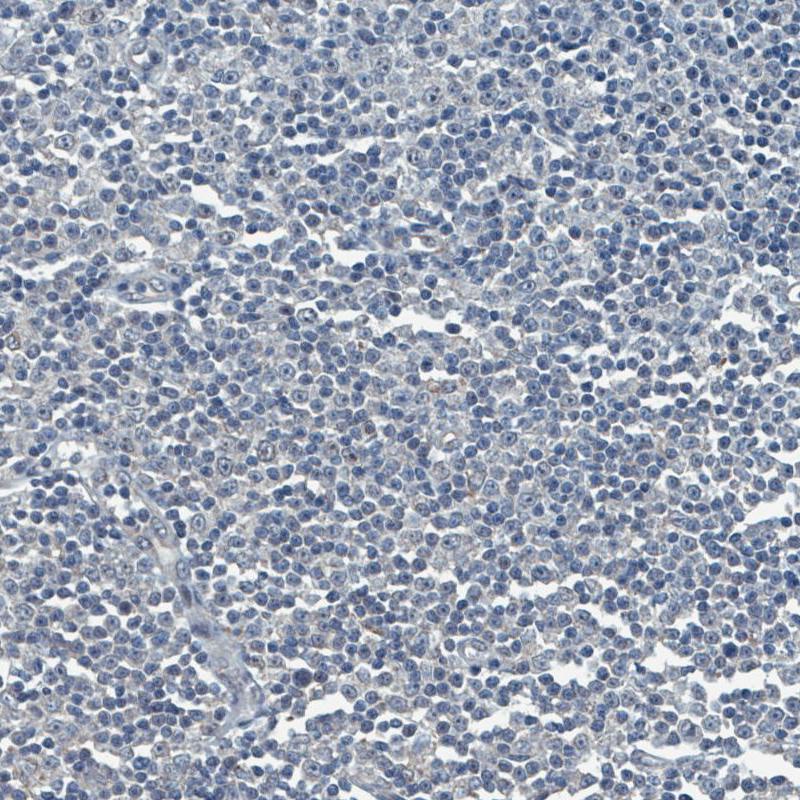 SOX11 Antibody (CL0142) - BSA Free Immunohistochemistry: SOX11 Antibody (CL0142) [NBP3-52441]