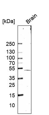 SOX11 Antibody (CL0142) - BSA Free Western Blot: SOX11 Antibody (CL0142) [NBP3-52441]