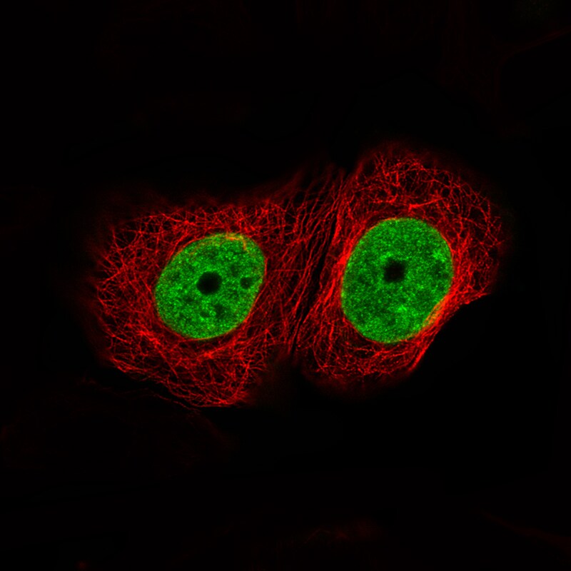 ATAD2 Antibody (CL0182) - BSA Free Immunocytochemistry/ Immunofluorescence: ATAD2 Antibody (CL0182) [NBP2-14786]