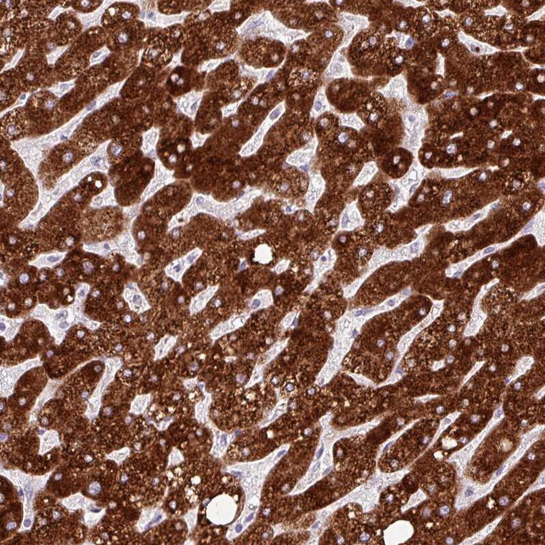FATP5/SLC27A5 Antibody (CL0213) - BSA Free Immunohistochemistry-Paraffin: FATP5/SLC27A5 Antibody (CL0213) [NBP2-14788]
