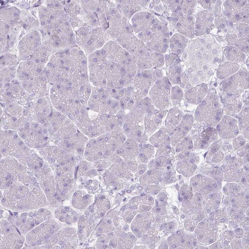 FATP5/SLC27A5 Antibody (CL0213) - BSA Free Immunohistochemistry-Paraffin: FATP5/SLC27A5 Antibody (CL0213) [NBP2-14788]