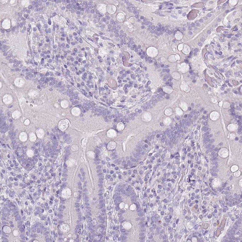FATP5/SLC27A5 Antibody (CL0213) - BSA Free Immunohistochemistry-Paraffin: FATP5/SLC27A5 Antibody (CL0213) [NBP2-14788]