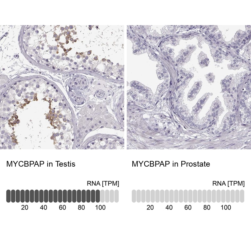 MYCBPAP Antibody - BSA Free Immunohistochemistry-Paraffin: MYCBPAP Antibody [NBP2-14790]