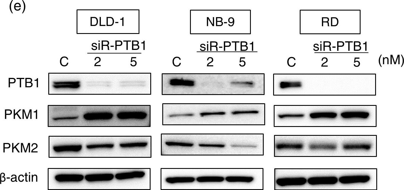 PKM1 Antibody - BSA Free