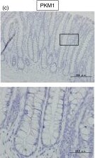 PKM1 Antibody - BSA Free