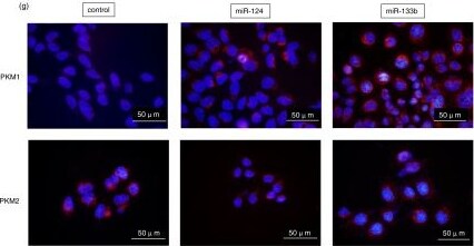 PKM1 Antibody - BSA Free