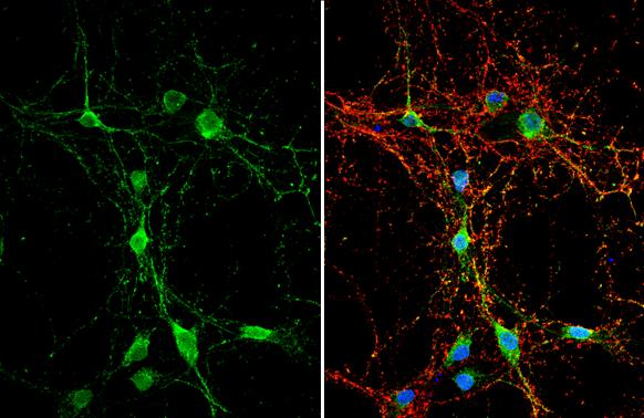 Dystroglycan Antibody - BSA Free