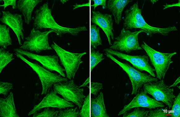 Tubulin Beta 2C Antibody - BSA Free
