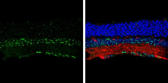 BMPR-IB/ALK-6 Antibody - BSA Free