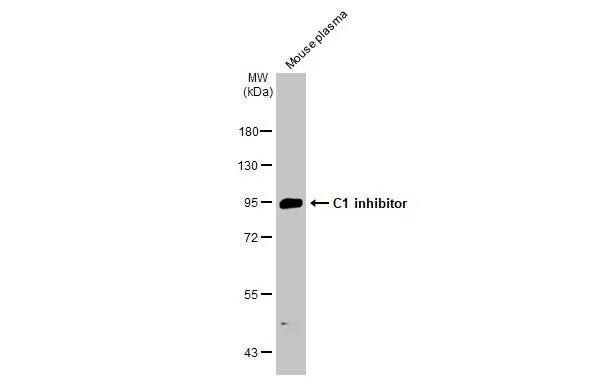 Serpin G1/C1 Inhibitor Antibody