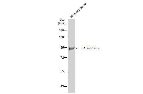 Serpin G1/C1 Inhibitor Antibody