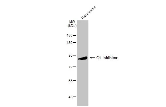 Serpin G1/C1 Inhibitor Antibody