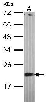 Centrin 1 Antibody