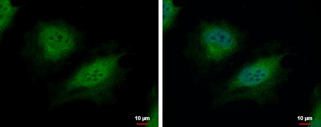 CSRP2BP Antibody