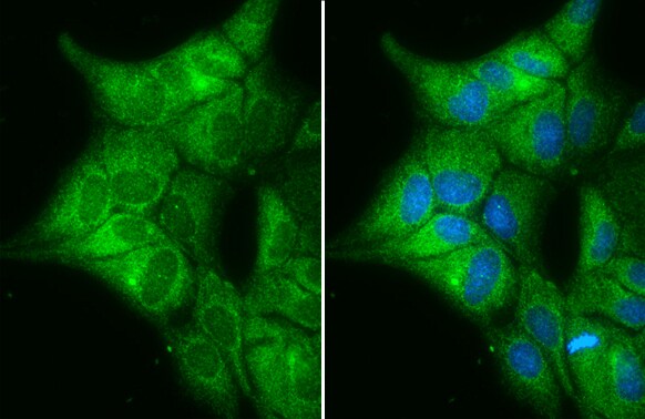Cytochrome b5 type A Antibody