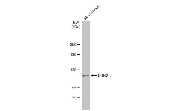 DDR2 Antibody