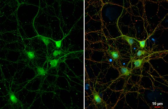 DDR2 Antibody