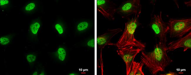 ETV5/ERM Antibody - BSA Free