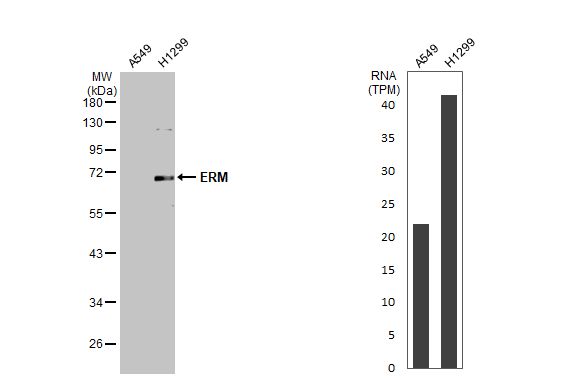 ETV5/ERM Antibody - BSA Free