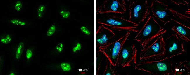 Exosome component 5 Antibody