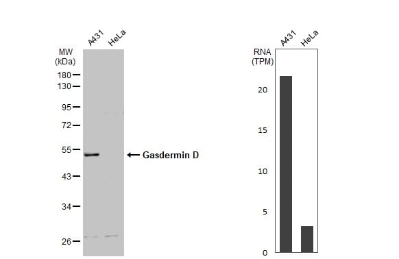 GSDMDC1 Antibody