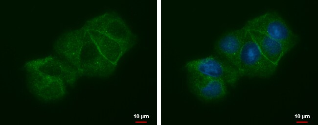 LIN7 Antibody