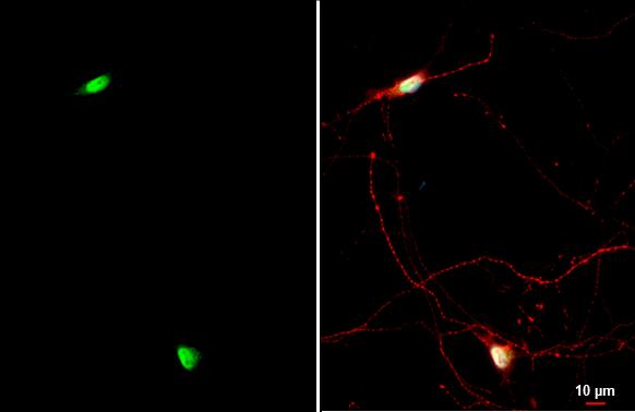 NFIX Antibody
