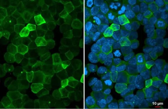 P2Y2 Antibody