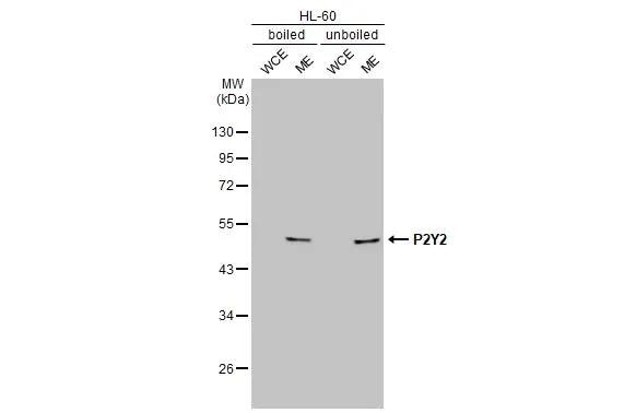 P2Y2 Antibody - BSA Free