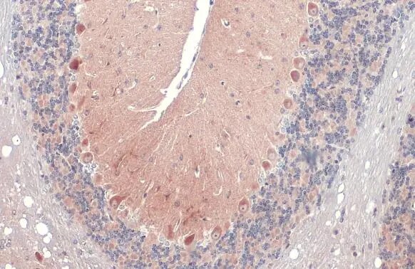 RAB11B Antibody