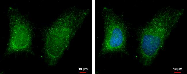 RAB11B Antibody - BSA Free