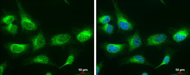 LRPAP Antibody