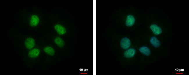RBMY1F Antibody