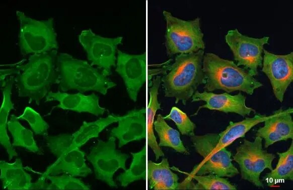 Ribosomal Protein L24 Antibody