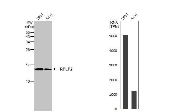 RPLP2 Antibody