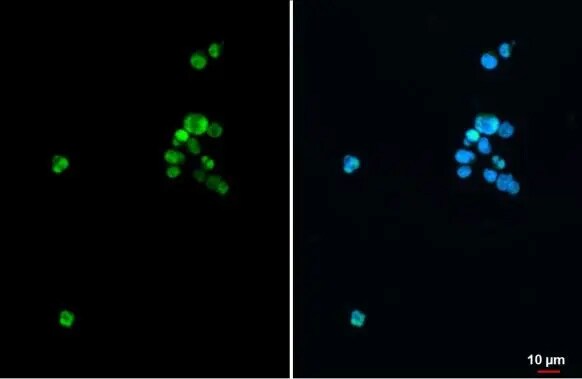 SATB1 Antibody