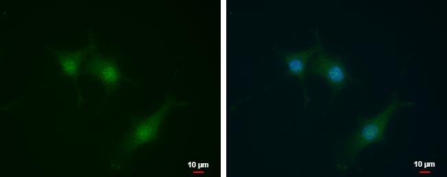 SEC14L2 Antibody - BSA Free