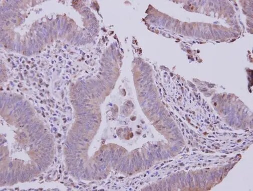 solute carrier family 22, member 18 antisense Antibody