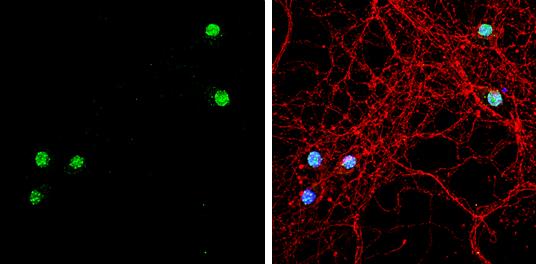 TBR1 Antibody