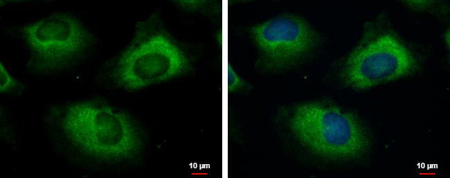 UBE2R2 Antibody