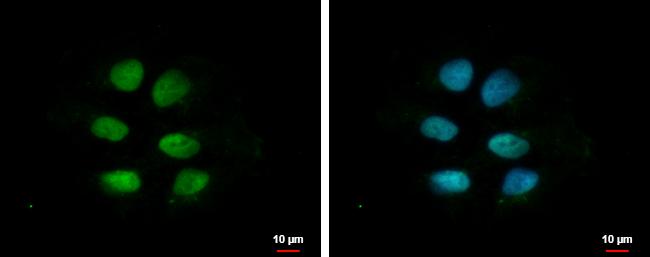ZNF571 Antibody - BSA Free