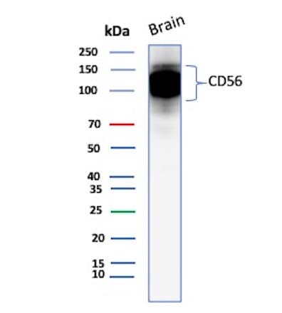 NCAM-1/CD56 Antibody (123C3.D5) Western Blot: NCAM-1/CD56 Antibody (123C3.D5) [NBP2-15184] -