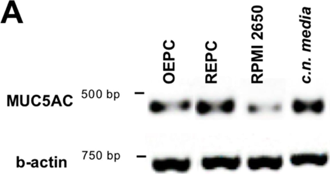 MUC5AC Antibody (45M1)