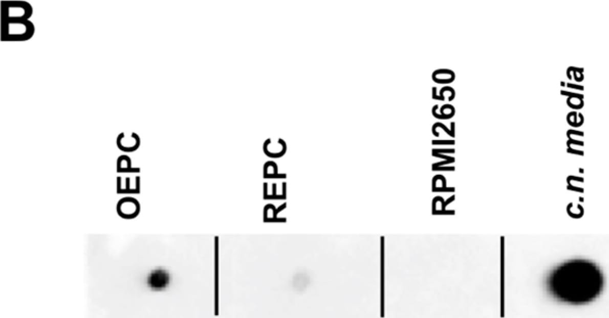 MUC5AC Antibody (45M1)