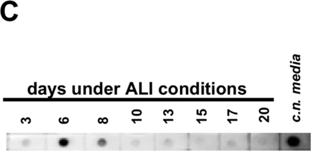 MUC5AC Antibody (45M1)