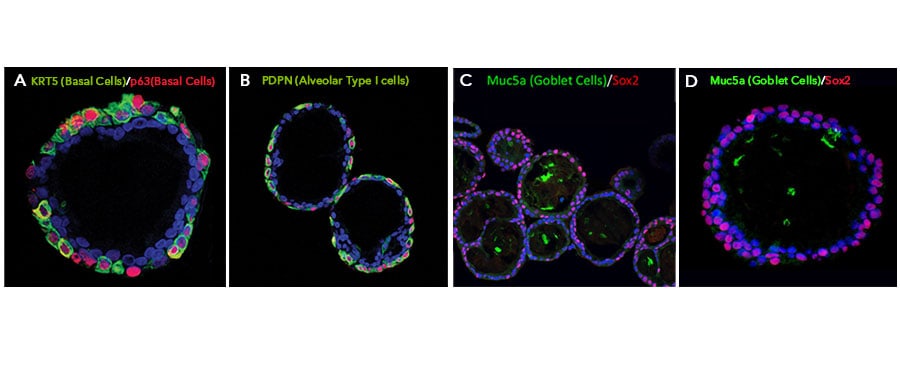MUC5AC Antibody (45M1)