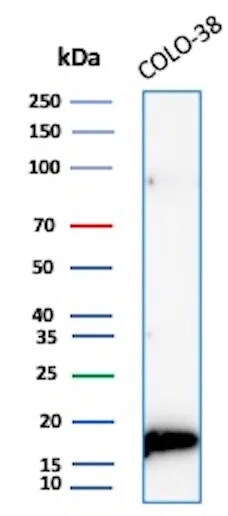 Melan-A/MART-1 Antibody (M2-7C10) Western Blot: Melan-A/MART-1 Antibody (M2-7C10) [NBP2-15197] -