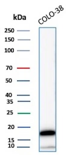 Melan-A/MART-1 Antibody (M2-7C10) Western Blot: Melan-A/MART-1 Antibody (M2-7C10) [NBP2-15197] -