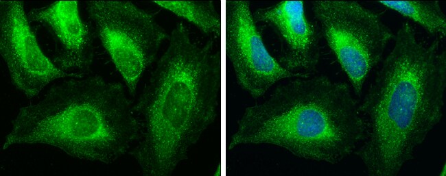 ACAA1 Antibody