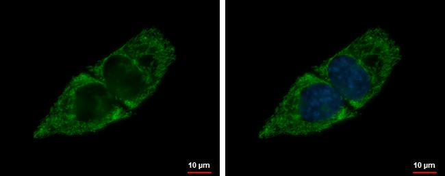 ACADSB Antibody - BSA Free